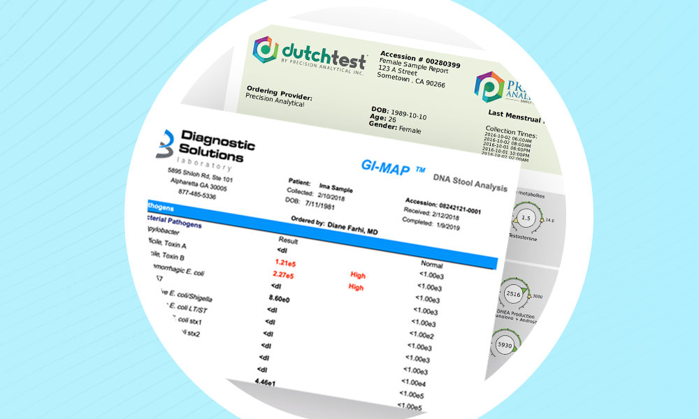 Essentials on Ordering and Interpreting DUTCH Complete and GI Map